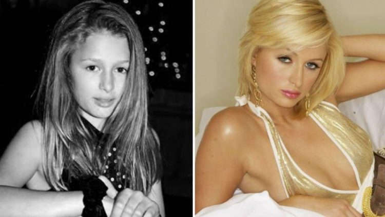 Школьные фото знаменитостей: 30 снимков до и после