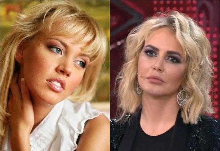 Российские звезды, которые решились на пластику, 30 фото
