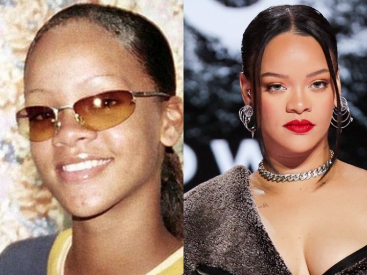 How Fame and Fortune Changed Beloved Celebs: 25 Before&After Photos