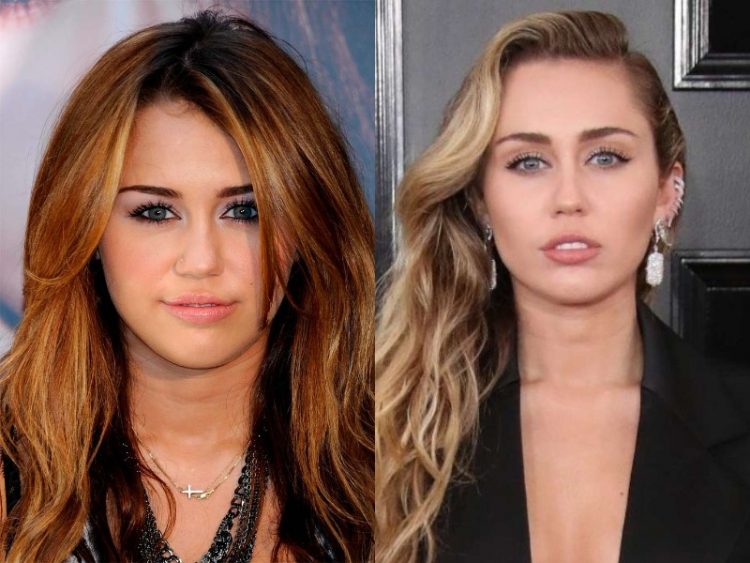 How Fame and Fortune Changed Beloved Celebs: 25 Before&After Photos