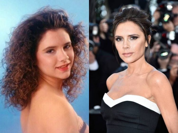 How Fame and Fortune Changed Beloved Celebs: 25 Before&After Photos