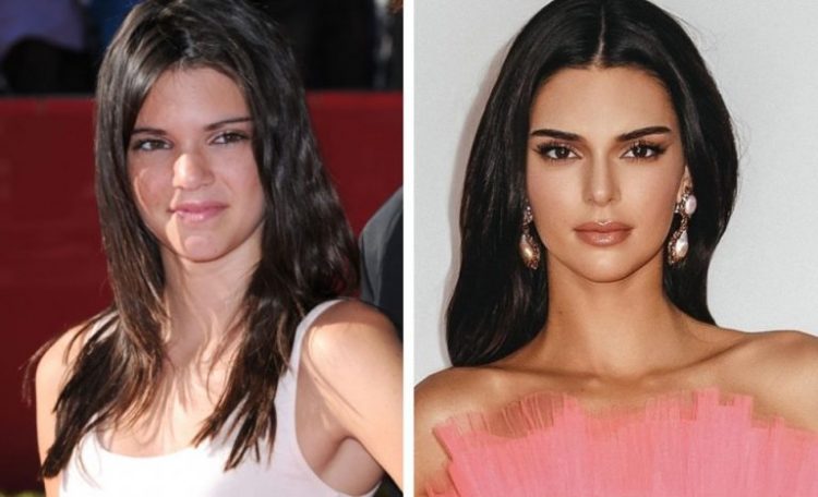 How Fame and Fortune Changed Beloved Celebs: 25 Before&After Photos