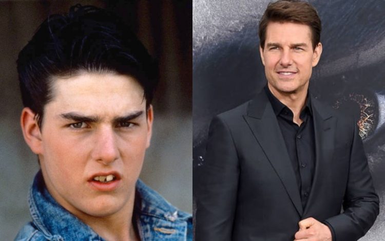 How Fame and Fortune Changed Beloved Celebs: 25 Before&After Photos