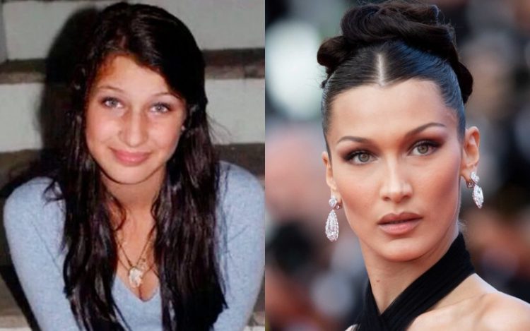 How Fame and Fortune Changed Beloved Celebs: 25 Before&After Photos